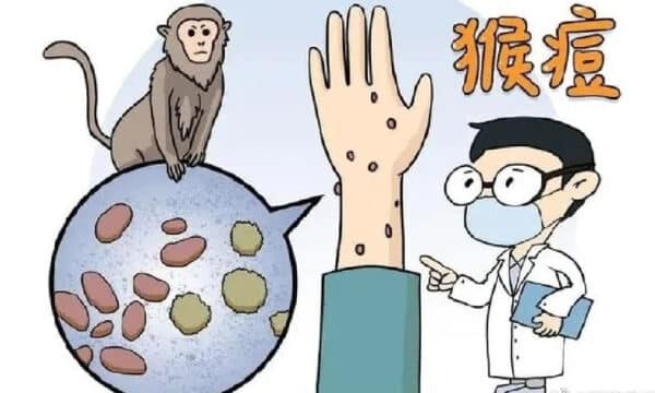 Confirmed Case of Monkeypox in Liaoning (Updated: and in Changsha ...